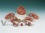 Brain Model with Arteries, 9 part